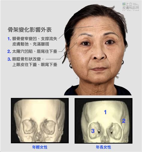 夫妻宮凹陷化解|夫妻宮凹陷化解方法有哪些